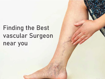 Finding the Best vascular Surgeon near you